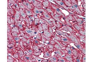 Anti-PSMB4 antibody IHC of human heart.