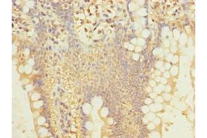 Immunohistochemistry of paraffin-embedded human small intestine tissue using ABIN7169695 at dilution of 1:100
