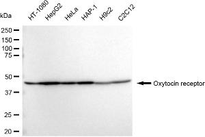 Western blotting analysis using Oxytocin receptor antibody (ABIN7799717).