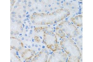 Immunohistochemistry of paraffin-embedded Mouse kidney using ASB4 Polyclonal Antibody at dilution of 1:100 (40x lens). (ASB4 Antikörper)