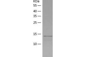 Western Blotting (WB) image for Endosulfine alpha (ENSA) (AA 2-121) protein (His tag) (ABIN7122780)