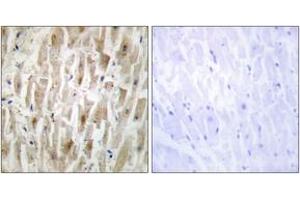 Immunohistochemistry (IHC) image for anti-LIM Domain Kinase 2 (LIMK2) (AA 461-510) antibody (ABIN2889517) (LIMK2 Antikörper  (AA 461-510))