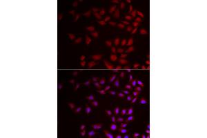 Immunofluorescence analysis of HeLa cells using CIRBP antibody (ABIN5973938). (CIRBP Antikörper)