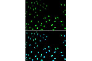 Immunofluorescence analysis of MCF-7 cells using RFC1 antibody. (RFC1 Antikörper)