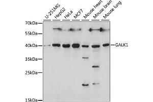 Western blot analysis of extracts of various cell lines, using G antibody (ABIN7267328) at 1:1000 dilution. (GALK1 Antikörper  (AA 1-120))