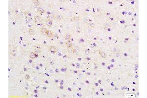 Formalin-fixed and paraffin embedded rat brain tissue labeled with Anti-ARHGAP32 Polyclonal Antibody, Unconjugated  at 1:200 followed by conjugation to the secondary antibody and DAB staining