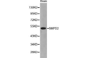 Western Blotting (WB) image for anti-Sphingomyelin phosphodiesterase 2, Neutral Membrane (Neutral Sphingomyelinase) (SMPD2) (AA 150-250) antibody (ABIN3021605) (SMPD2 Antikörper  (AA 150-250))