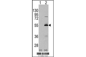Western blot analysis of ALDH6A1 using rabbit polyclonal ALDH6A1 Antibody using 293 cell lysates (2 ug/lane) either nontransfected (Lane 1) or transiently transfected with the ALDH6A1 gene (Lane 2). (ALDH6A1 Antikörper  (C-Term))