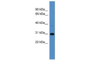 WB Suggested Anti-SERPINB8 Antibody Titration: 0. (SERPINB8 Antikörper  (C-Term))