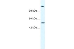 Western Blotting (WB) image for anti-DNA Helicase B (HELB) antibody (ABIN2461363)