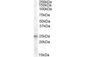Image no. 1 for anti-Insulin-Like Growth Factor Binding Protein 6 (IGFBP6) (Internal Region) antibody (ABIN374965) (IGFBP6 Antikörper  (Internal Region))
