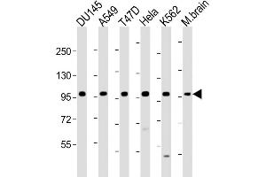 Western Blotting (WB) image for anti-Fibroblast Growth Factor Receptor 2 (FGFR2) (AA 22-51), (N-Term) antibody (ABIN391965)