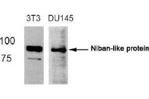 Image no. 2 for anti-Family with Sequence Similarity 129, Member B (FAM129B) (Ser712) antibody (ABIN319366)
