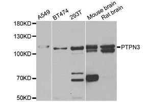 Western blot analysis of extracts of various cell lines, using PTPN3 antibody. (PTPN3 Antikörper)