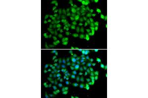 Immunofluorescence (IF) image for anti-Apolipoprotein B mRNA Editing Enzyme, Catalytic Polypeptide-Like 3C (APOBEC3C) antibody (ABIN1980244) (APOBEC3C Antikörper)