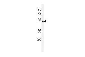 Western blot analysis of CHRNA3 Antibody (N-term) (ABIN651212 and ABIN2840133) in CEM cell line lysates (35 μg/lane). (CHRNA3 Antikörper  (N-Term))