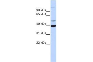 WB Suggested Anti-ZNF124 Antibody Titration:  0. (ZNF124 Antikörper  (Middle Region))