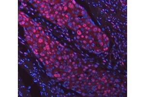 IF analysis of SNRPD2 using anti-SNRPD2 antibody (ABIN7598963).