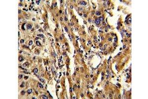 Immunohistochemistry (IHC) image for anti-ATP-Binding Cassette, Sub-Family G (WHITE), Member 1 (ABCG1) (AA 359-387) antibody (ABIN3030059)