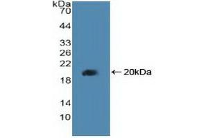 Detection of Recombinant PPARd, Human using Polyclonal Antibody to Peroxisome Proliferator Activated Receptor Delta (PPARd) (PPARD Antikörper  (AA 260-426))
