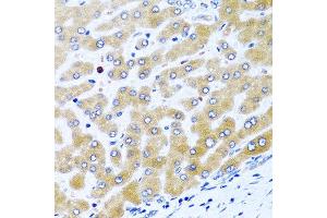 Immunohistochemistry of paraffin-embedded human liver using CCL21 antibody at dilution of 1:100 (40x lens). (CCL21 Antikörper)