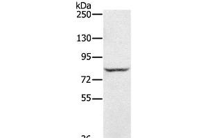 Western Blot analysis of Jurkat cell using RNF43 Polyclonal Antibody at dilution of 1:300