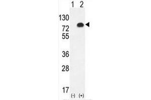 Western blot analysis of GPC6 (arrow) using rabbit polyclonal GPC6 Antibody (C-term) . (Glypican 6 Antikörper  (C-Term))