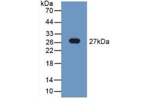 Detection of Recombinant TUBd, Rat using Polyclonal Antibody to Tubulin Delta (TUBd) (TUBD1 Antikörper  (AA 238-482))