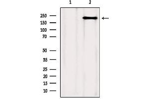 Western Blotting (WB) image for anti-Mechanistic Target of Rapamycin (serine/threonine Kinase) (mTOR) antibody (ABIN6263424)