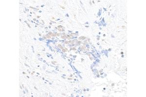Immunohistochemistry (IHC) image for anti-Chromodomain Helicase DNA Binding Protein 8 (CHD8) (AA 2252-2302) antibody (ABIN7454728)