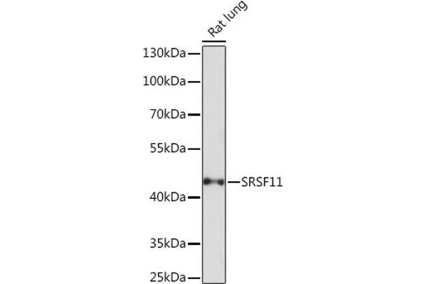 SRSF11 抗体
