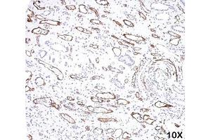 IHC testing of FFPE human kidney transplant tissue (10X) stained with C4d antibody (C4D204).