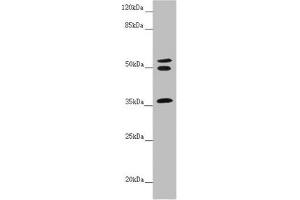 Western blot All lanes: RNF41 antibody at 5. (RNF41 Antikörper  (AA 1-317))