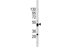 Western blot analysis of GATA4 antibody and CEM lysate. (GATA4 Antikörper  (AA 298-328))