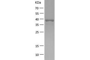 ELAC1 Protein (ELAC1) (AA 1-363) (His tag)