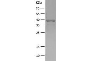 Western Blotting (WB) image for ELAC1 (ELAC1) (AA 1-363) protein (His tag) (ABIN7122752) (ELAC1 Protein (ELAC1) (AA 1-363) (His tag))