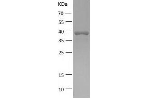 ELAC1 Protein (ELAC1) (AA 1-363) (His tag)