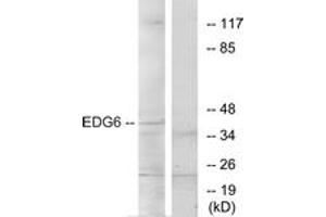 Western Blotting (WB) image for anti-Sphingosine-1-Phosphate Receptor 4 (S1PR4) (AA 326-375) antibody (ABIN2890766) (S1PR4 Antikörper  (AA 326-375))