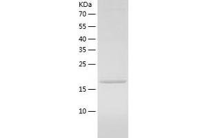 Western Blotting (WB) image for Signal Recognition Particle 14kDa (Homologous Alu RNA Binding Protein) (SRP14) (AA 1-160) protein (His tag) (ABIN7125090) (SRP14 Protein (AA 1-160) (His tag))