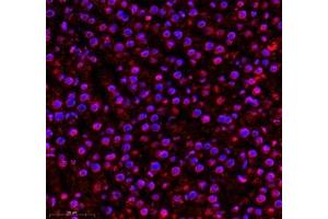 Immunofluorescence of paraffin embedded rat liver using AQP0 (ABIN7074547) at dilution of 1: 300 (400x lens) (MIP Antikörper)