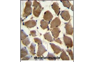 LRP3 Antibody (C-term) (ABIN390097 and ABIN2840611) immunohistochemistry analysis in formalin fixed and paraffin embedded human skeletal muscle followed by peroxidase conjugation of the secondary antibody and DAB staining.