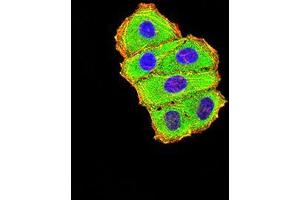 Immunofluorescence analysis of Hela cells using C3C mouse mAb (green). (Complement C3c Antikörper  (AA 1521-1649))