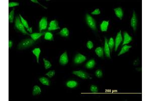 Immunofluorescence (IF) image for anti-Ribosomal Protein S5 (RPS5) (AA 106-204) antibody (ABIN519885)