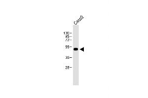 Anti-WTIP Antibody (C-term) at 1:500 dilution + Caco2 whole cell lysate Lysates/proteins at 20 μg per lane.