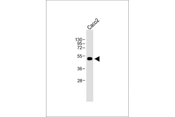 WTIP Antikörper  (AA 243-271)