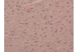 IHC-P analysis of Mouse Heart Tissue, with DAB staining. (alpha 2 Macroglobulin Antikörper  (AA 1053-1214))