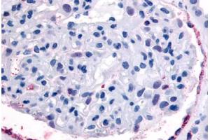 Anti-EPHA4 antibody  ABIN1048570 IHC staining of human kidney, glomerulus. (EPH Receptor A4 Antikörper  (Internal Region))