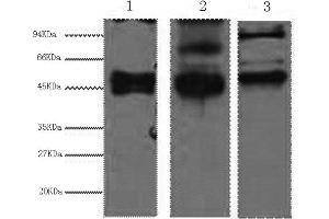 Western Blotting (WB) image for anti-Keratin 17 (KRT17) antibody (ABIN5959216) (KRT17 Antikörper)