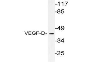 Western blot (WB) analyzes of VEGF-D antibody in extracts from COS-7 cells. (VEGFD Antikörper)