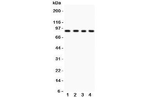 Western blot testing of IKKb antibody and Lane 1:  HEPG2;  2: COLO320;  3: M231;  4: HT1080 lysate.